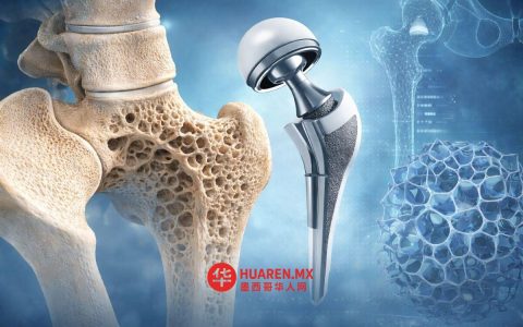 海绵状骨结构：现代人工关节设计的核心