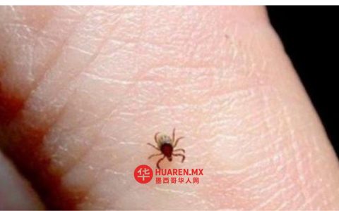 奇瓦瓦州立克次体病病例持续增加，卫生部门维持疫情警戒